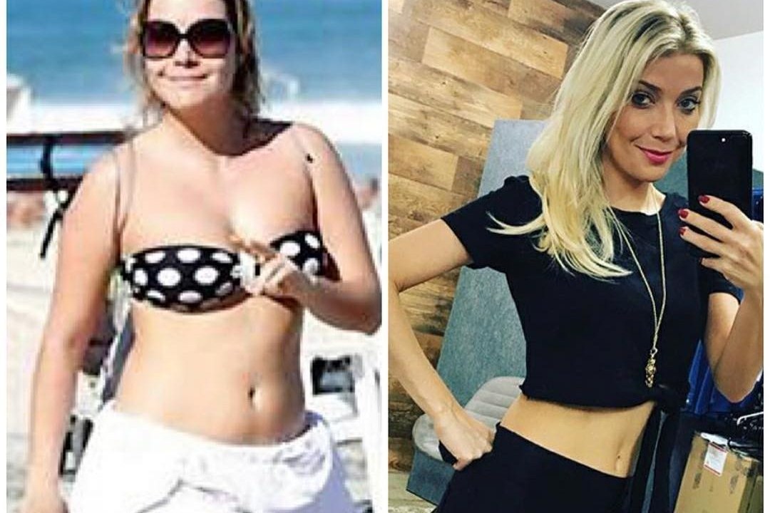 Foto de antes e depois da cantora Luiza Possi