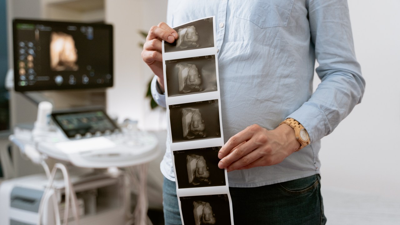 imagens de um ultrassom de grávida