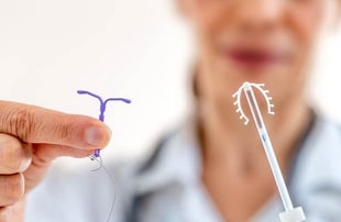 Mirena, Kyleena, Cobre, Prata: conheça os tipos de DIUs