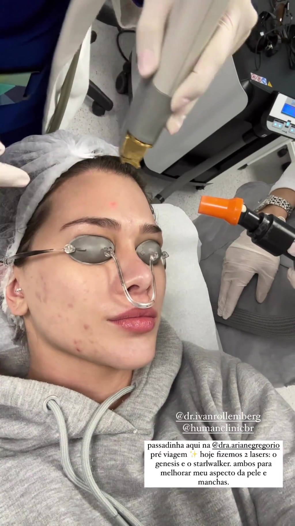 Flavia Pavanelli fazendo laser no rosto