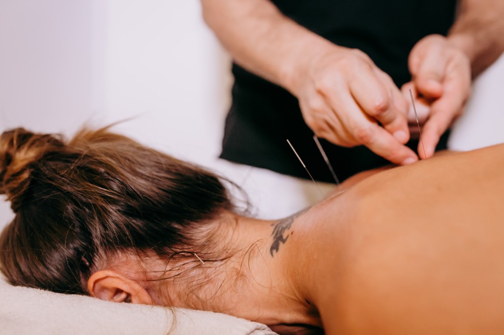 acupuntura no tratamento de lesões