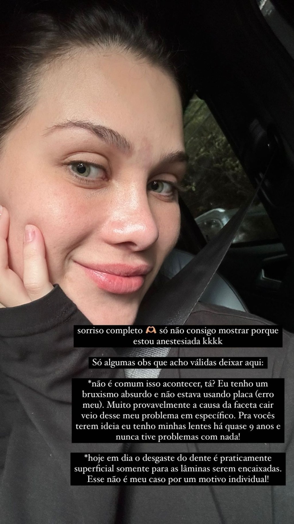 Flavia Pavanelli perde lente de contato dental