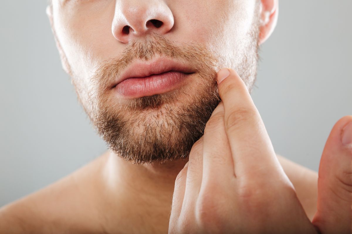 5 dicas para quem tem espinhas na regi o da barba BOA FORMA