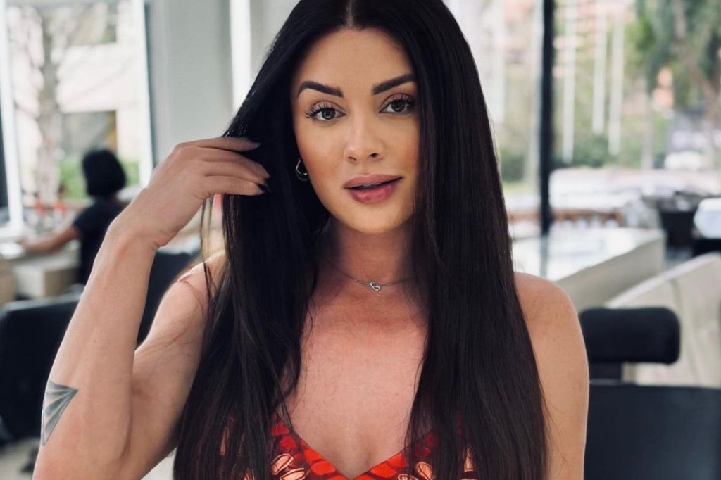 Juju Salimeni revela ter psoríase: ‘Disfarçava com maquiagem’