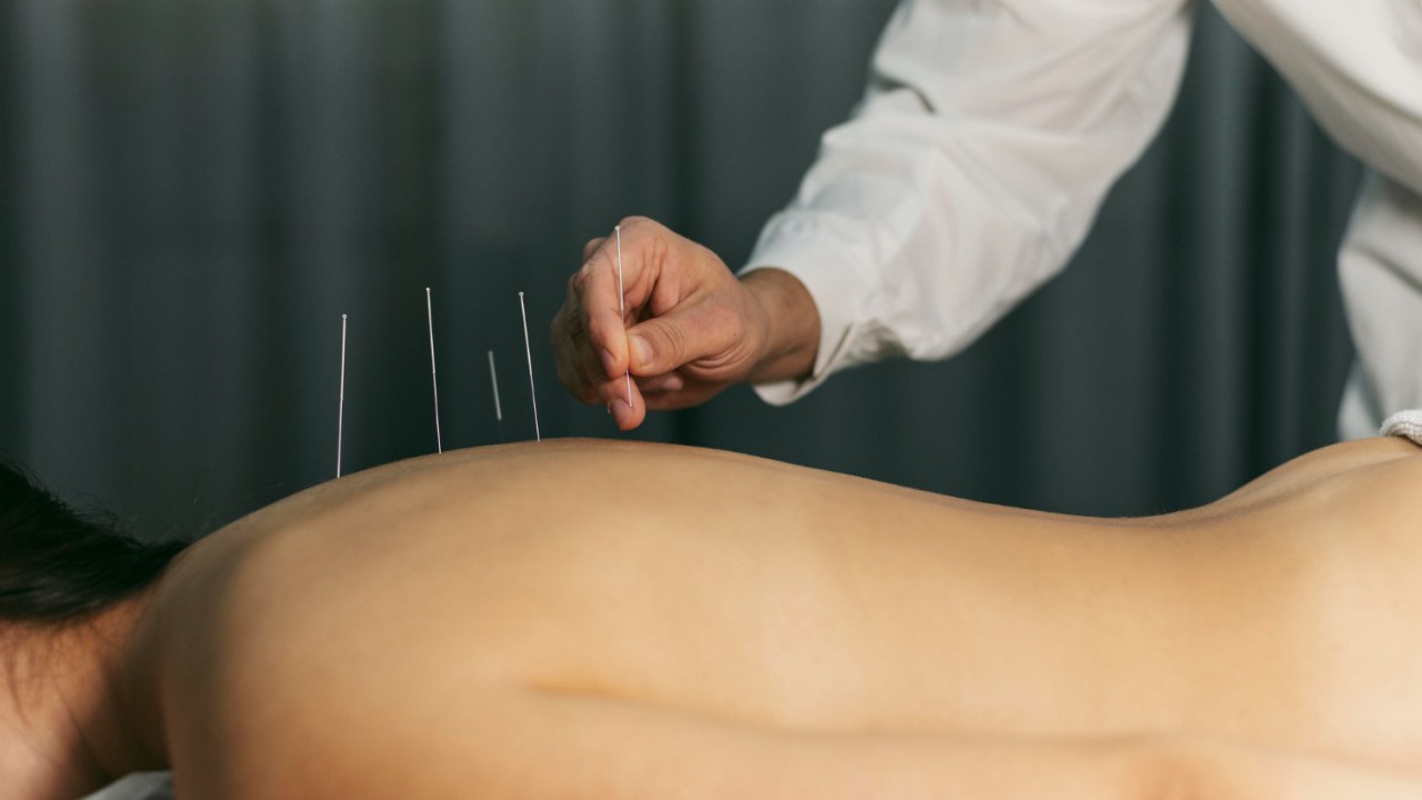 terapias alternativas no cancer de mama | acupuntura