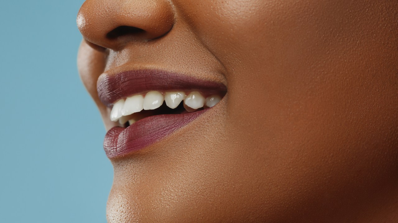 Veja os riscos dos alimentos ácidos para os dentes