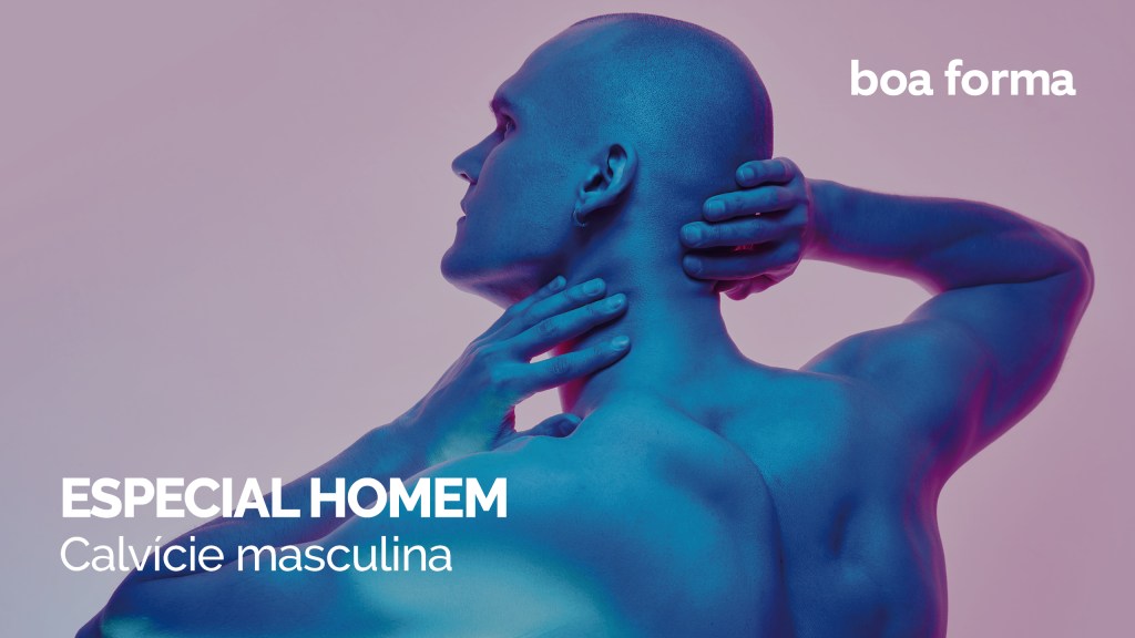 Calvície masculina: guia completo sobre como evitar e tratar