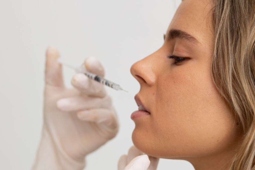 Retirada de preenchimento labial: a técnica que usa hialuronidase para reverter mudanças estéticas