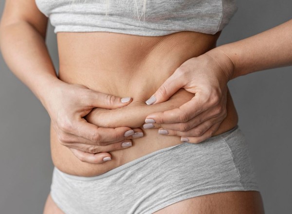 Quantas calorias são necessárias para ganhar 1kg de gordura