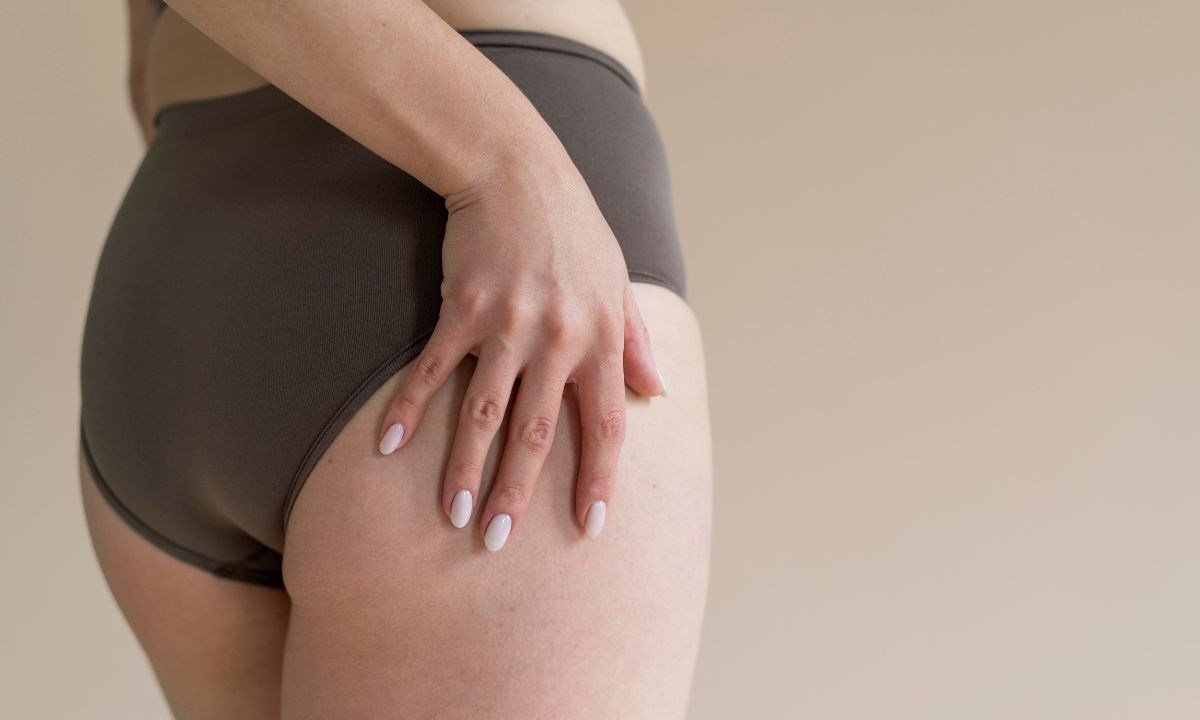 lipedema sem drama